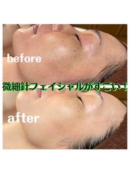 ヌーベルコピーヌ/お得な回数券も販売中！！