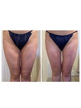 ルナグランデ 心斎橋店(Luna grande.)/隙間が広がっていく