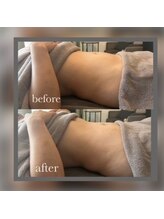 アズユウ(As U)/腸もみデトックス