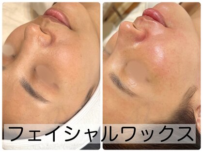 シシエル(CHICIEL)の写真