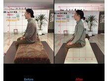 ストレチックス 近江八幡店/BeforeAfter