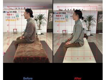 ストレチックス 近江八幡店/BeforeAfter