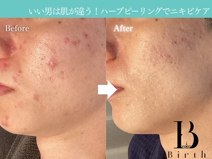 バース(Birth...)の写真