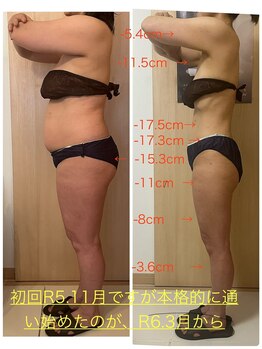 エステサロン エレガンス/