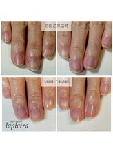 ネイルサロン ラピエトラ(la pietra)/最強のネイルケア３ケ月間コース