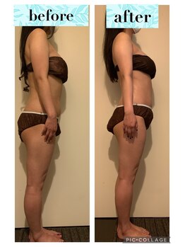 マンダ 田町(Manda)/ブライダル前のケアにもおすすめ