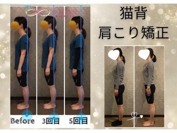 プルーム 大橋店(plume)/猫背矯正/肩こり