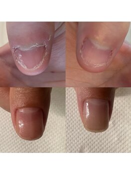 カンパニュラ(Campanula)/