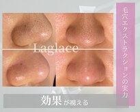 ラグラス(Laglace)
