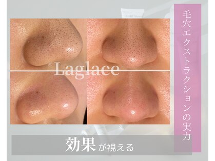 ラグラス(Laglace)の写真