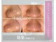 ラグラス(Laglace)の写真