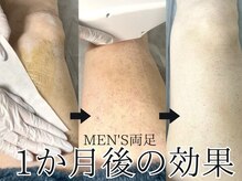 ミルダ(MIRUDA)の雰囲気（ワックス×光脱毛の【ダブル脱毛】でチクチクもしない♪）
