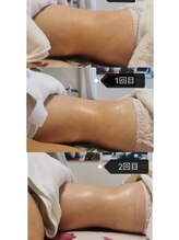 シークレット(Secret)/痩身