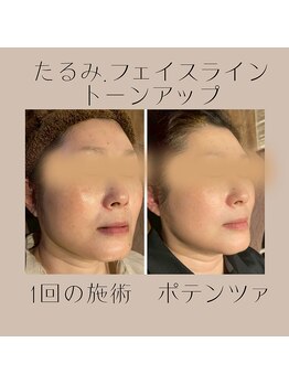 ナナイロ(nanairo)/