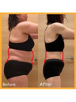 れん(REN)/好きな服が着れる！