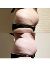 ヨサパーク ボヌール 門司駅店(YOSA PARK bonheur)/30代プレミアムコース通って14日