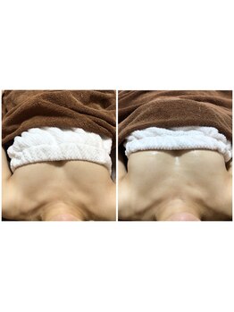 隠れ家エステサロン ミンピ(Mimpi)/ふっくら美バストケア