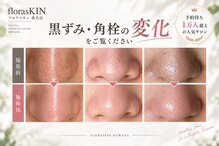 フロラスキン 桑名店(florasKIN)