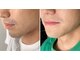 チャット(CHAT)の写真