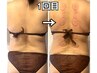 【上半身集中痩身】痩身集中カッピング+セルケア 100分 ¥15000→¥10000