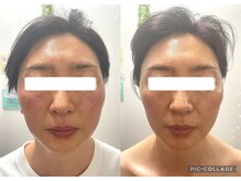 はれる接骨院 ウェリナ(Welina)/1回で実感、続けて確信。