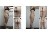 【最強痩身】★エンダモロジー&最新サーモのW体験★80300円→29800円