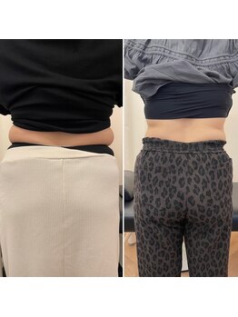 ナオ接骨院(NAO接骨院)/Before/After