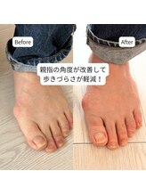 はやと整体院/５０代女性（歩きづらい）