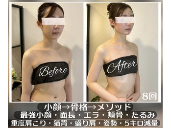 ソウ バイ ソウ(So by 蒼)/日本唯一の速攻変化メソッド。