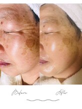 ワンダー(Wonder)/大人女性こそ艶肌で差をつける♪