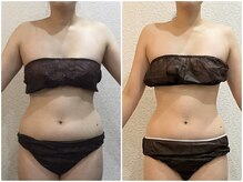 美容整体ウェリナ あま甚目寺院/小顔矯正/骨盤矯正/美脚サロン