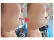 ミール(Meel)/【３回での効果】