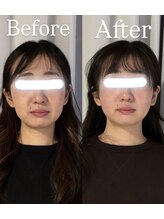 サロンドベベ(salon de Bebe.)/お客様ビフォーアフター