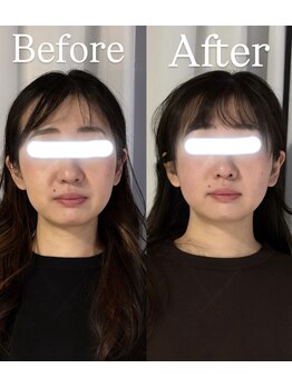 サロンドベベ(salon de Bebe.)/お客様ビフォーアフター