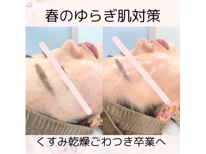 ギフト(gift)の写真