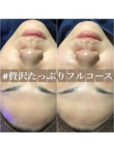 エステルーム クリスタル/贅沢たっぷりフルコース