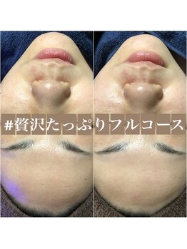 エステルーム クリスタル/贅沢たっぷりフルコース