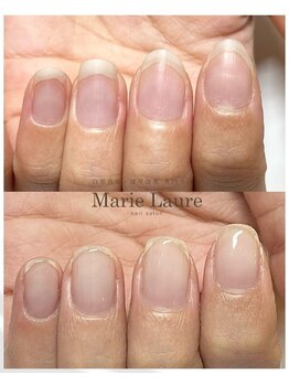 マリーロール 梅田店(Marie Laure)/自爪育成/深爪矯正/ネイルケア