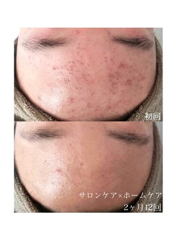 ベル(Belle)/【艶玉肌セルマン】