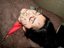 スカイ 鍼灸整骨院 整体院(SKY)