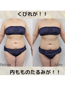 サロン ド ベルメール(Salon de Belle mer)/リンパマッサージ/痩身/リンパ