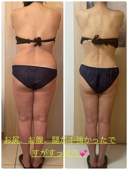 エステサロン エレガンス/