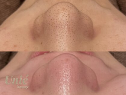 ユニエビューティー(Unie Beauty)の写真