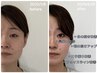 【先着5名様限定】モニター募集！50分メニュー×4回/57,200円→28,600円