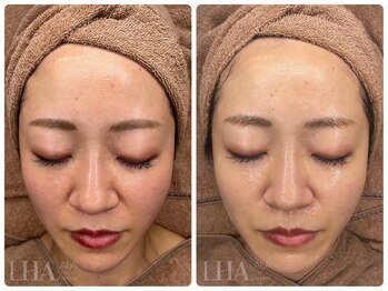 ピュアソル 枚方店(Puresol)/