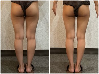 美容整体ウェリナ 名駅院/小顔矯正/骨盤矯正/美脚サロン