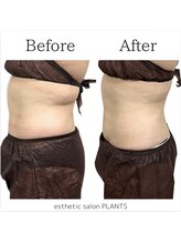 プランツ(PLANTS)/20代／３回／お腹ケア・腸活