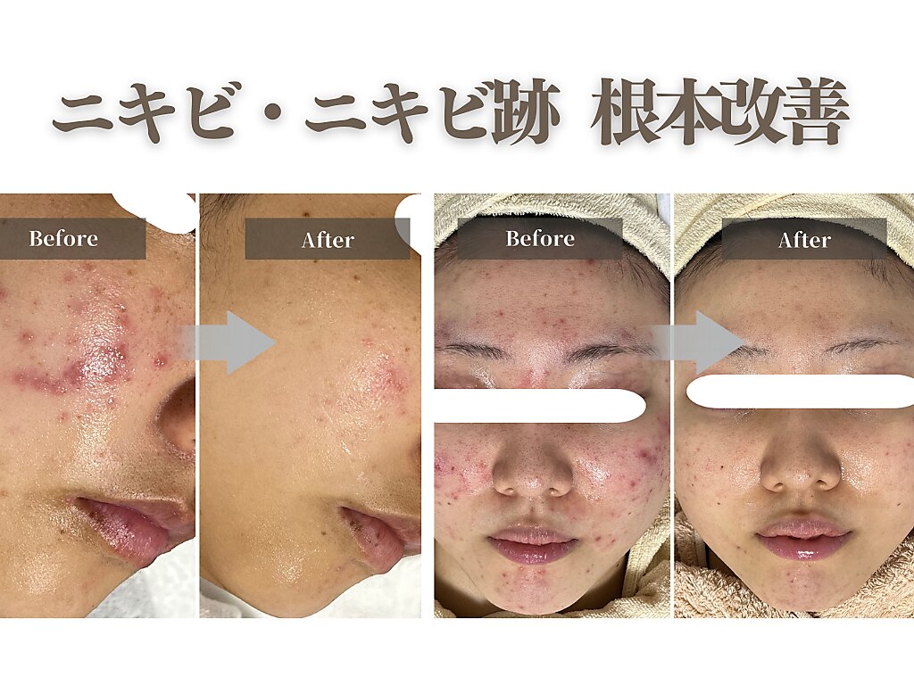 エミルカ 天王寺店(EMILUCA)｜ホットペッパービューティー