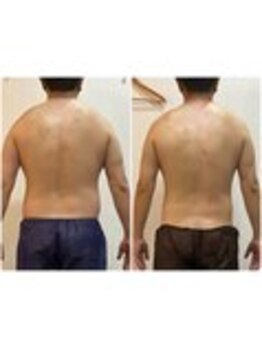 ウェリナ平和堂長久手院/小顔矯正/骨盤矯正/美脚サロン