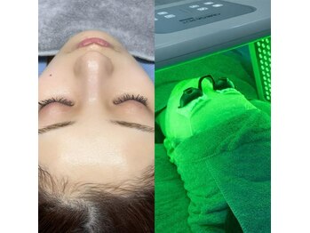 オンダム 表参道(ONDAM)の写真/【将来の肌まで見据えたエイジングケア】韓国式肌管理をベースに肌全体を整え、シミ・しわにもアプローチ。